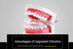 Invisible Braces Orthodontic Braces